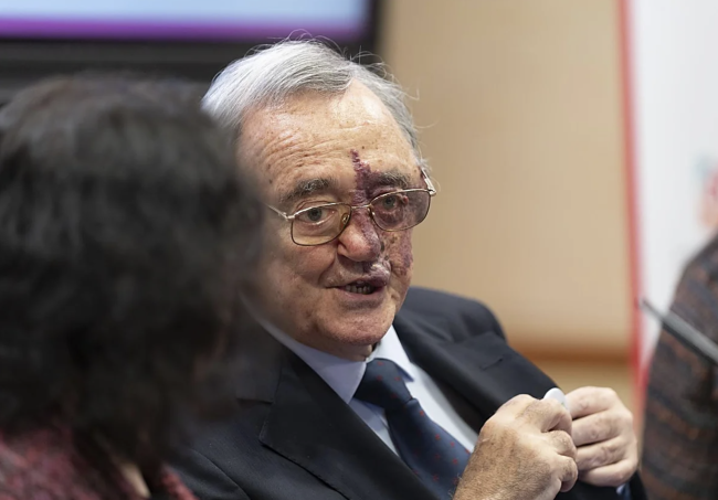 膵臓がん研究におけるスペインの画期的な進展を支援するための資金調達キャンペーン開始