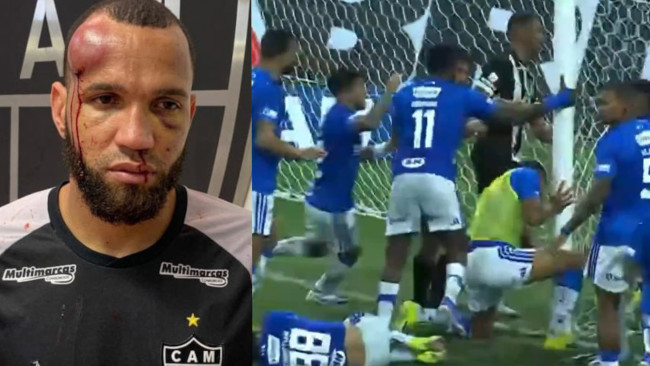 ブラジルでの激しい激闘は23人の選手が退場し、重傷を負う